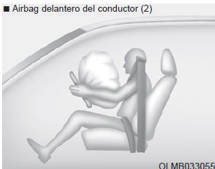 Componentes y funciones del SRS